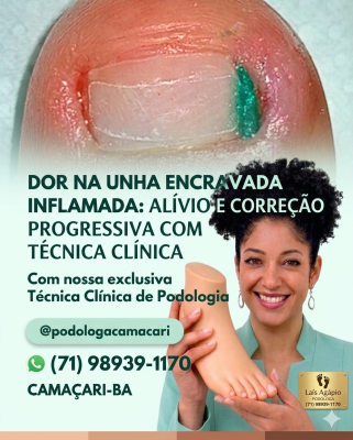 Podóloga Laís Agápio - Especialista em Unha Encravada foto 1